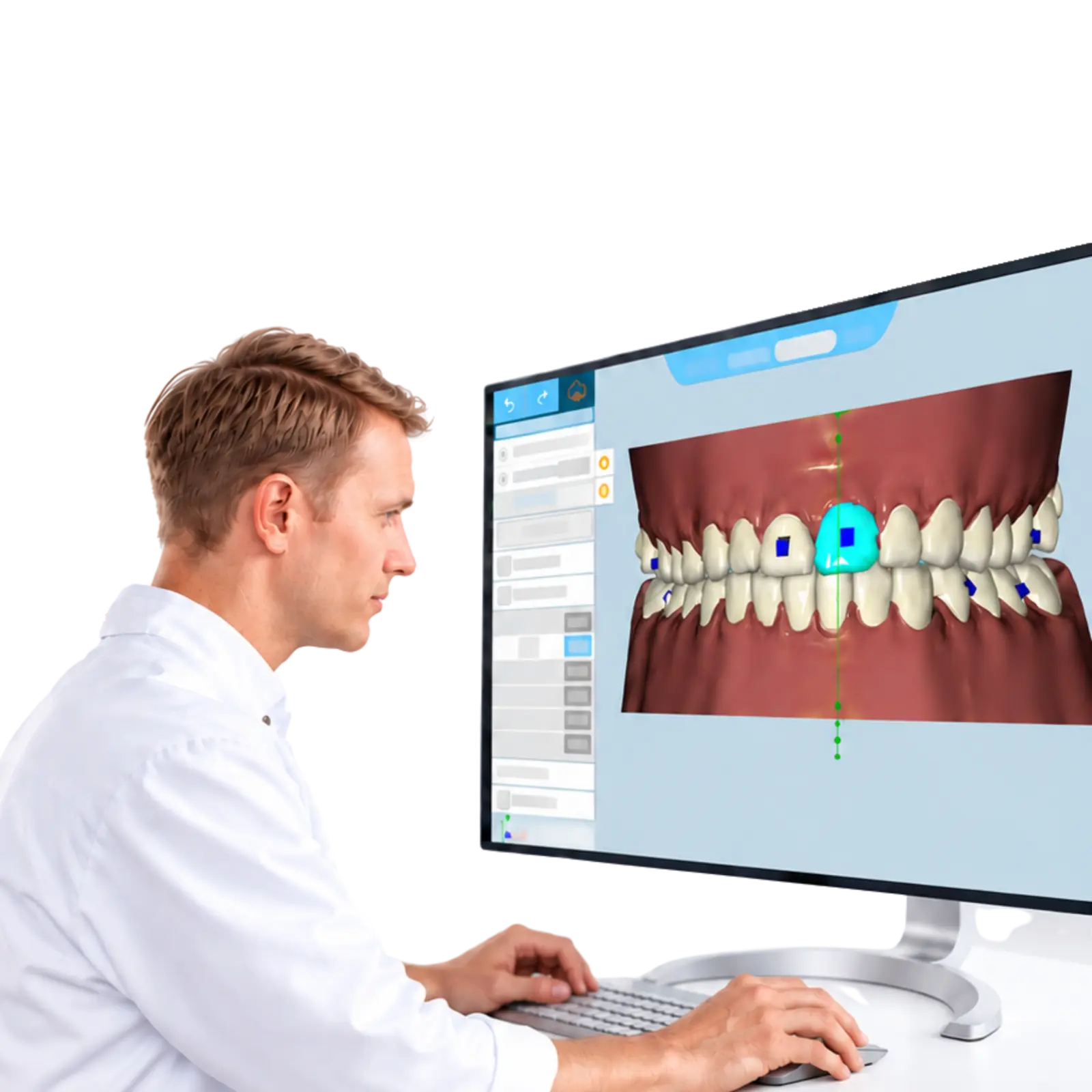 SmileWide 3D treatment plan