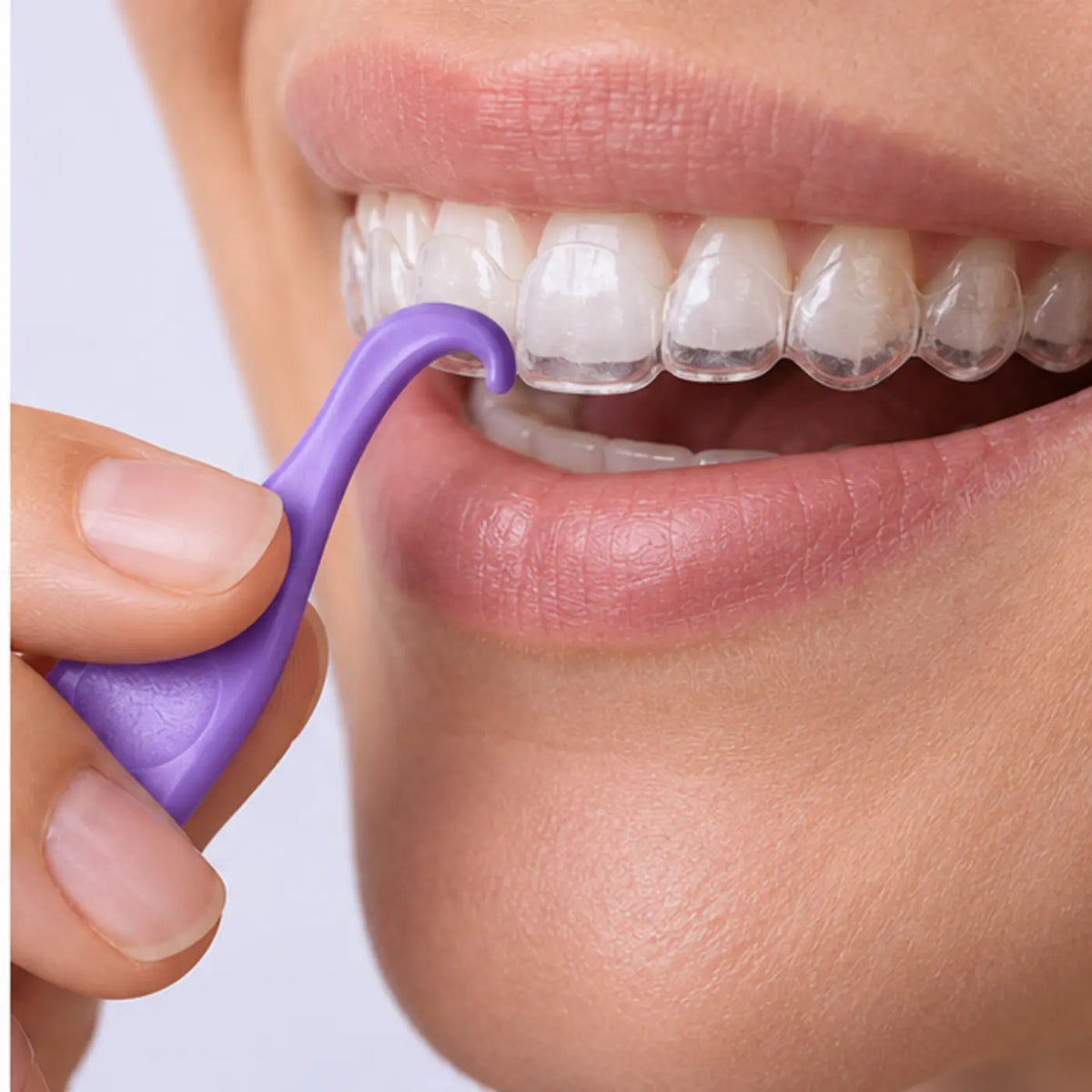 SmileWide Aligner Removal Tool – product in use