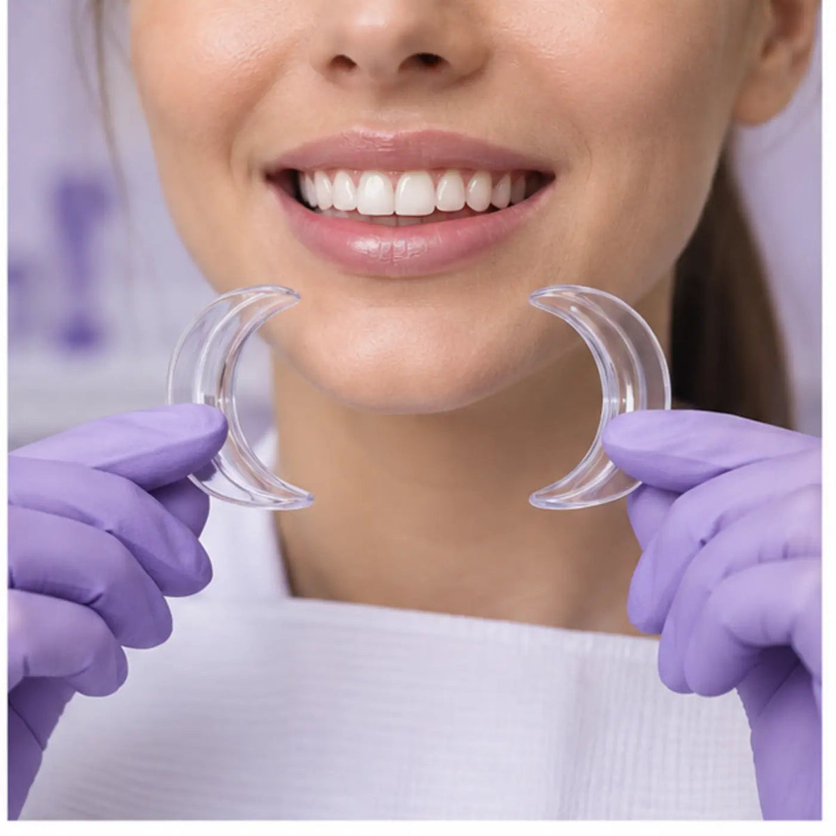 SmileWide Dental Cheek Retractor – product in use