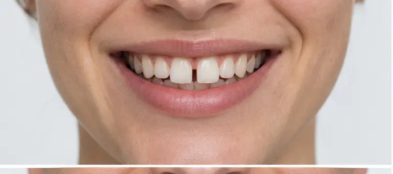 AI-generated smile before alignment — illustration, not a patient