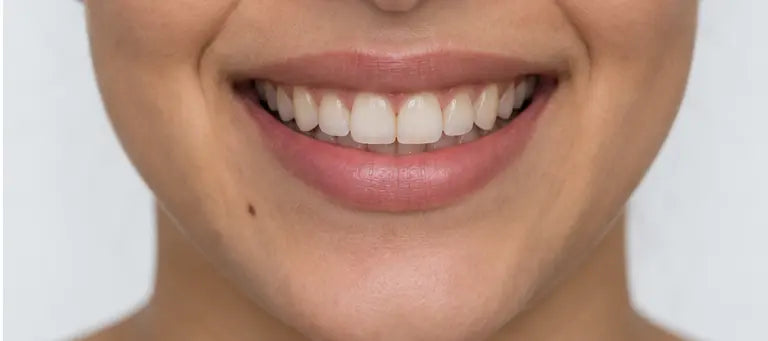AI-generated aligned smile — illustration, not a treatment result